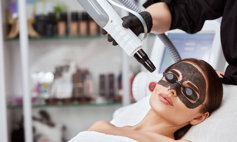 Carbon Peel Laser Treatment